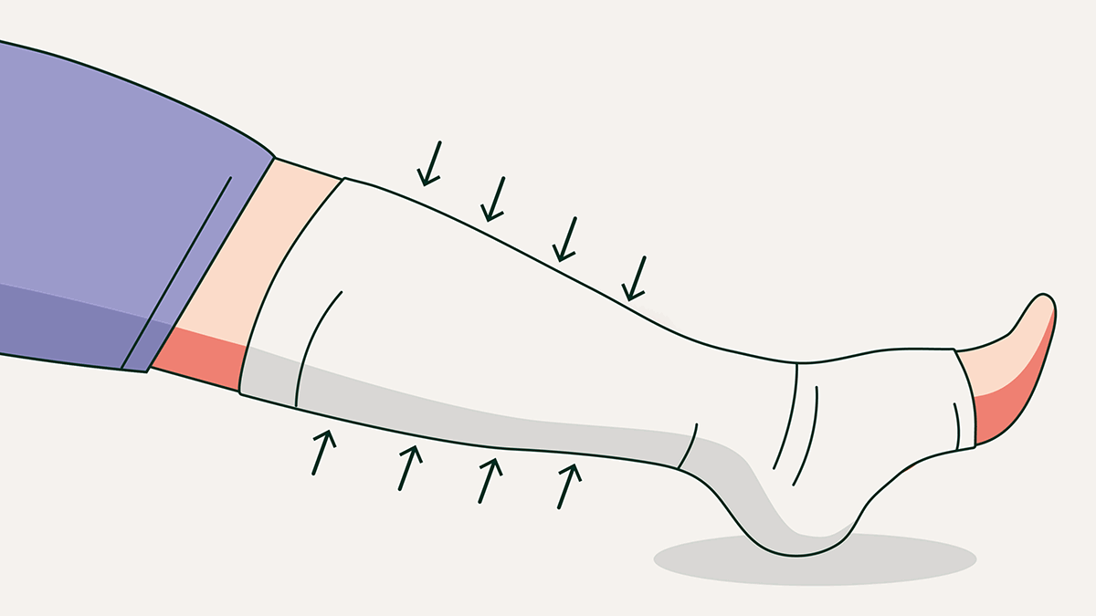 A leg with compression bandage. Illustration.