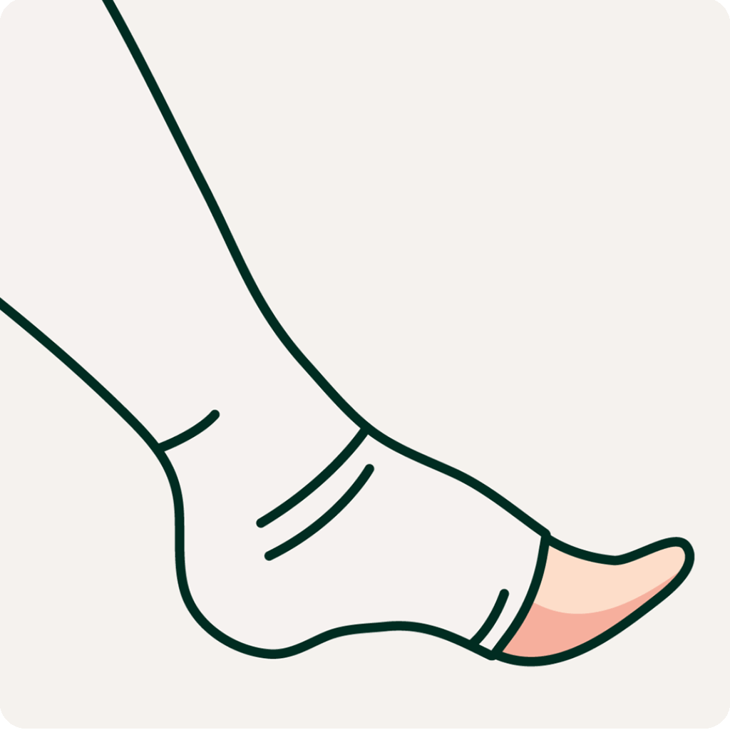 A leg with a compression bandage. Illustration.